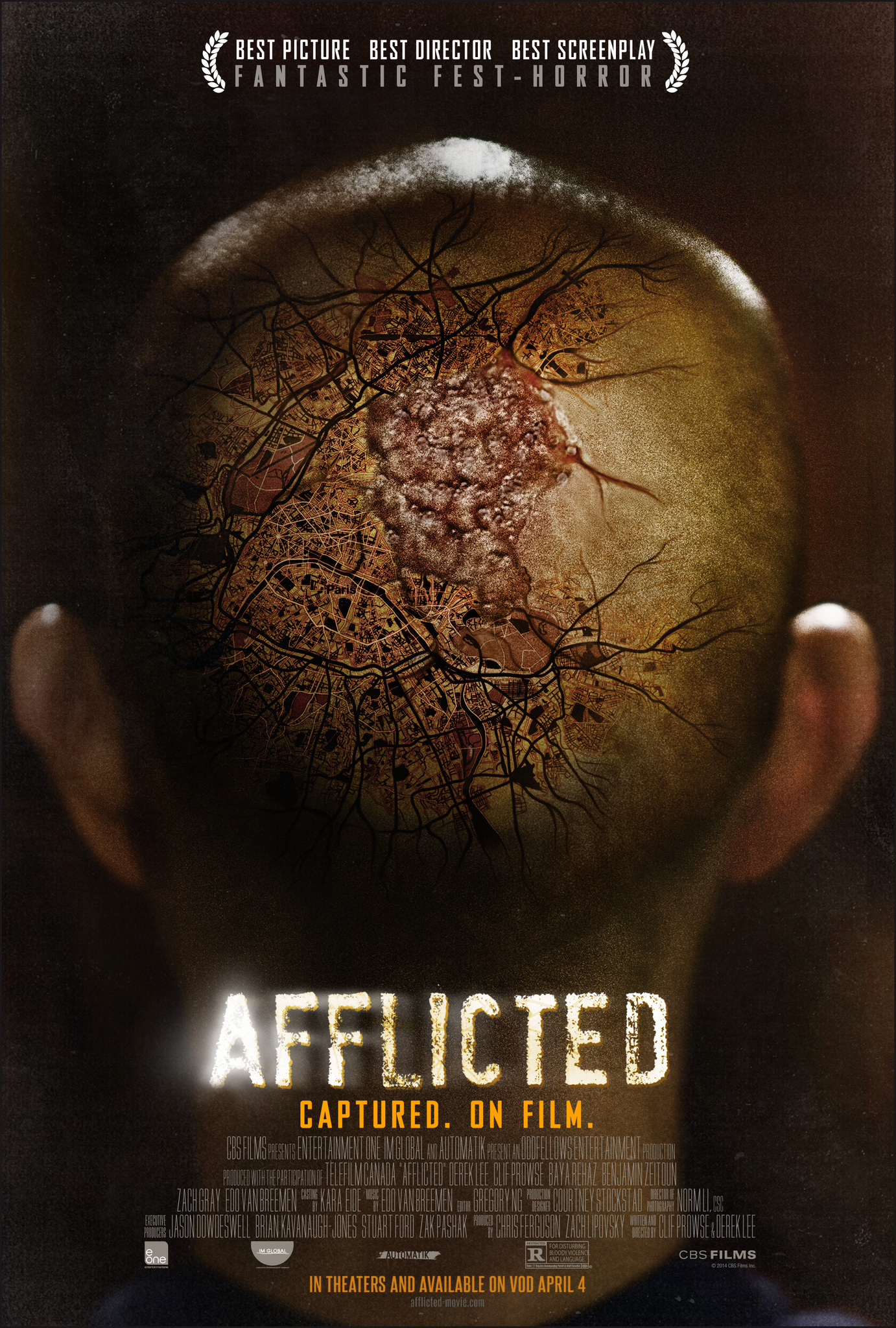 Nonton film Afflicted layarkaca21 indoxx1 ganool online streaming terbaru